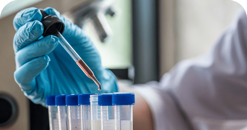 Lab Tests
