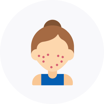 Dermatologist | Apka Muaalij Dermatologist | Apka Muaalij
