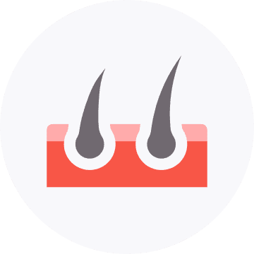 Hair Loss | Apka Muaalij Hair Loss | Apka Muaalij