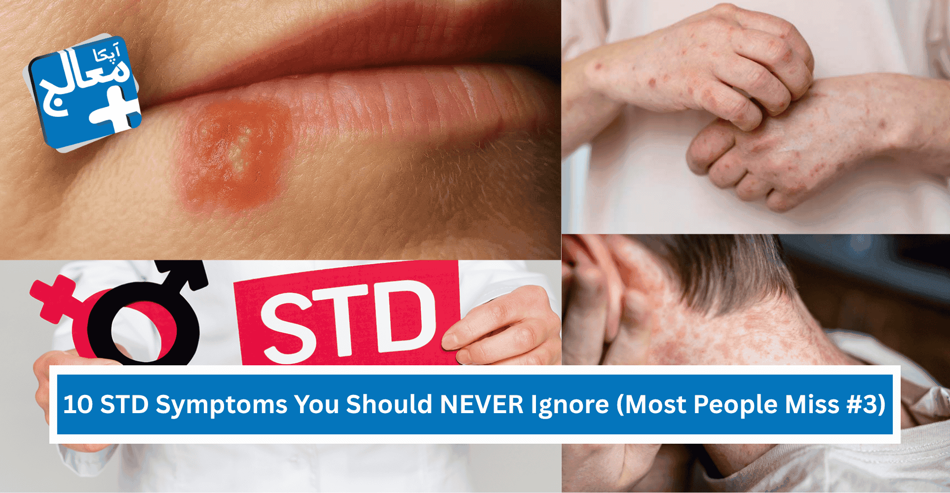 10 STD Symptoms You Should NEVER Ignore (Most People Miss #3) | Apka Muaalij 10 STD Symptoms You Should NEVER Ignore (Most People Miss #3) | Apka Muaalij