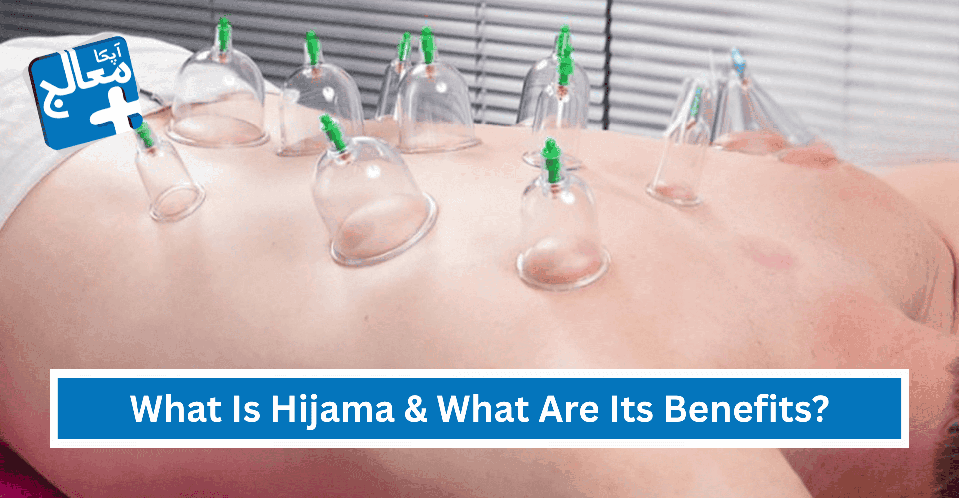 Apka Muaalij | What Is Hijama & What Are Its Benefits?