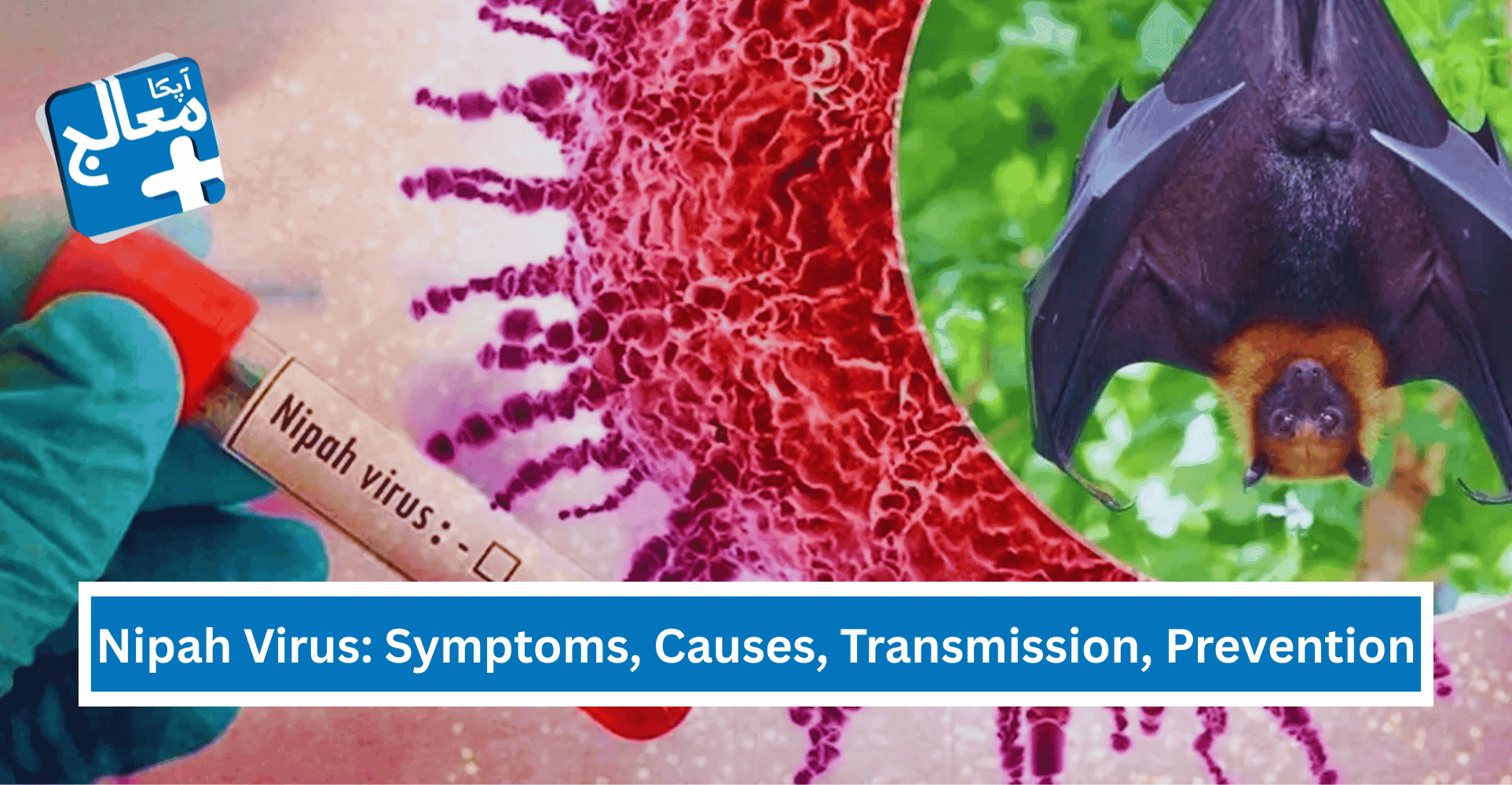 Nipah Virus: Symptoms, Causes, Transmission, Prevention, & Updates | Apka Muaalij Nipah Virus: Symptoms, Causes, Transmission, Prevention, & Updates | Apka Muaalij